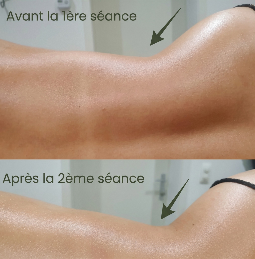 avant après séance maderothérapie