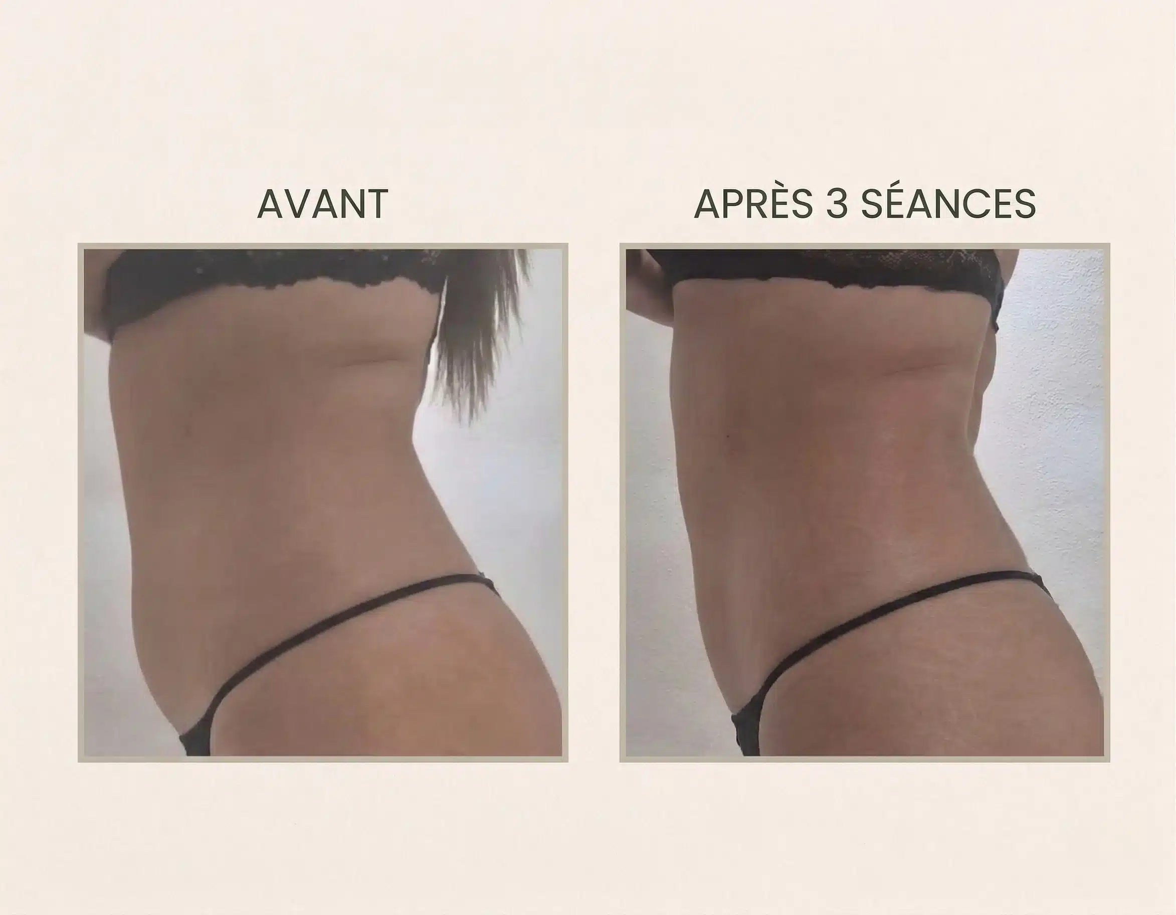 avant après séance maderothérapie